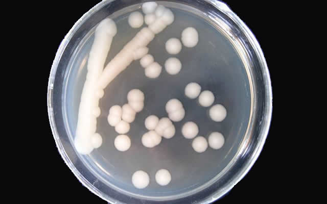胶质芽孢杆菌