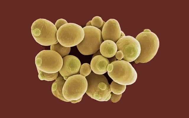 酵母菌——发酵之母