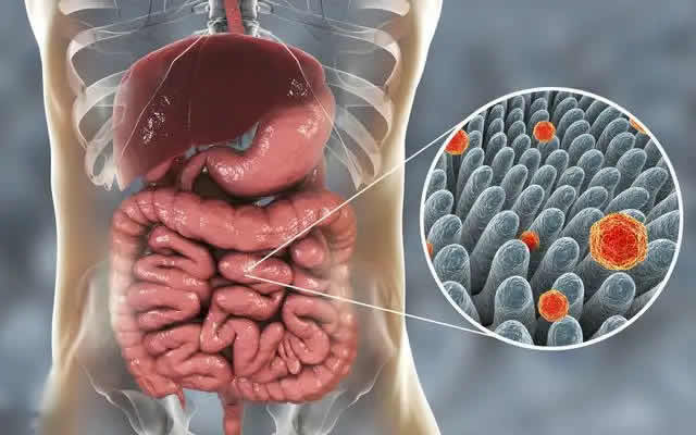 肠道细菌是如何促进癌症治疗的？