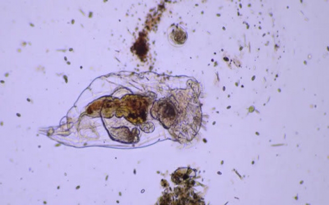 高倍显微镜下观察到的微生物，有没有觉得生命就是个奇迹！