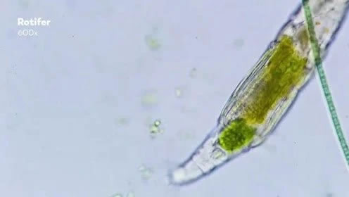 微观世界，显微镜下的微生物正在进食细菌大餐